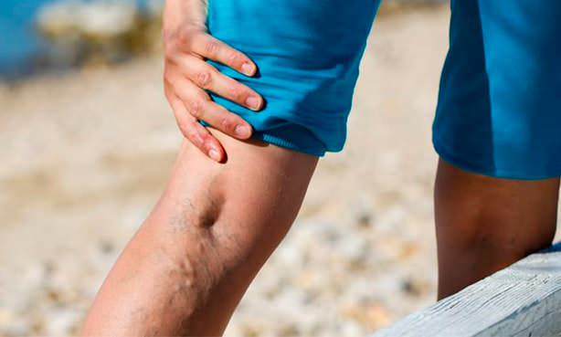 Вена на ноге набухла и болит