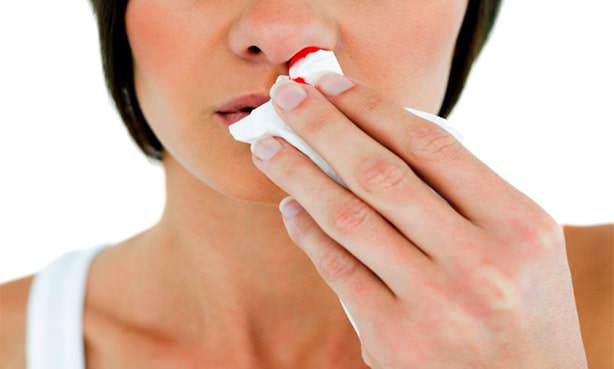 Носовое кровотечение