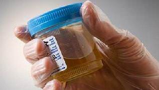 слизь в моче причины