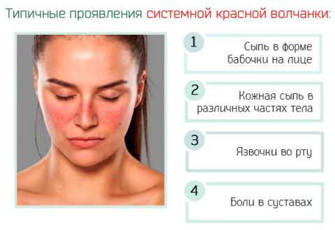 mielofibroz_prichiny Как диагностировать и лечить миелофиброз?