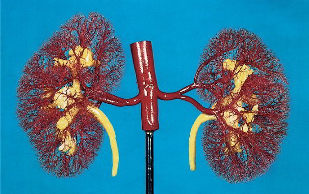 Почечная недостаточность