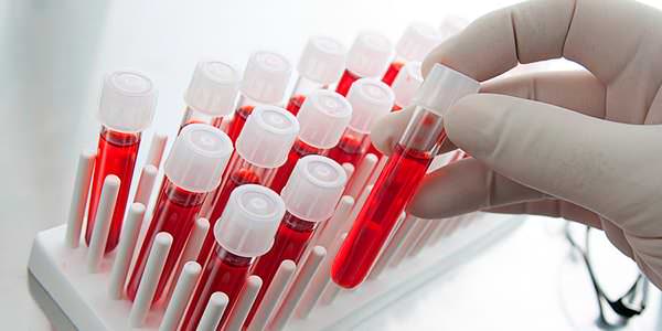 анализ на эритроциты