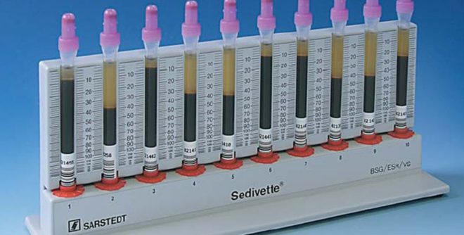 сдаем анализ крови