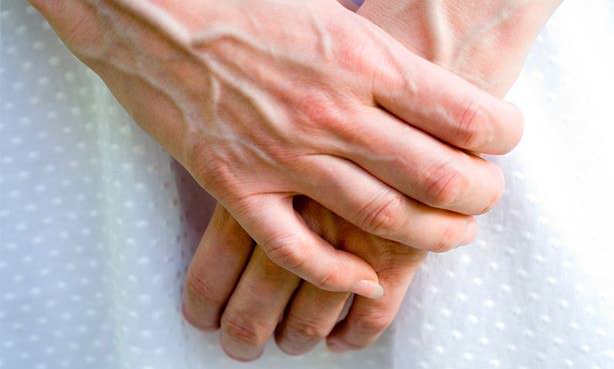 Выступающие вены на руках