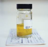 в моче билирубин