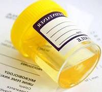 Почему эритроциты в моче повышены