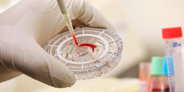 анализ на тиф