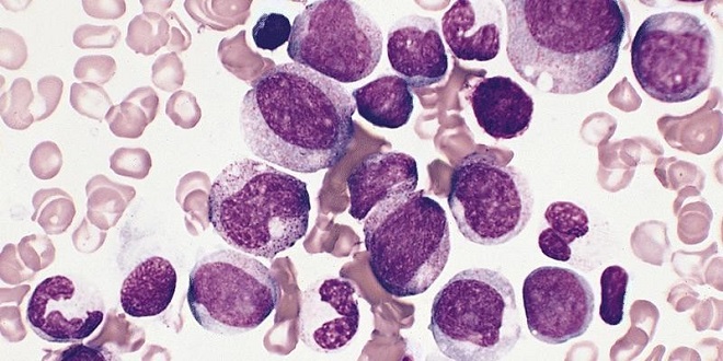 моноцитоз у детей