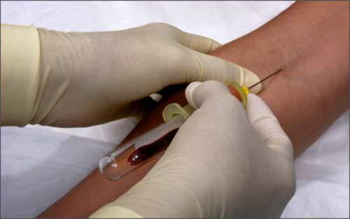 Забор крови из вены