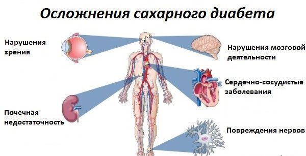 Осложнения сахарного диабета