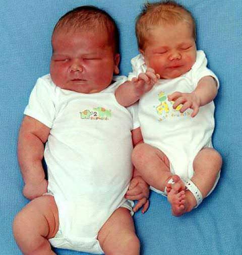 Диабетическая фетопатия