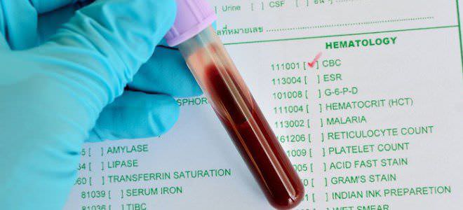 Гематокрит понижен - что делать?