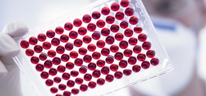 СОЭ в крови