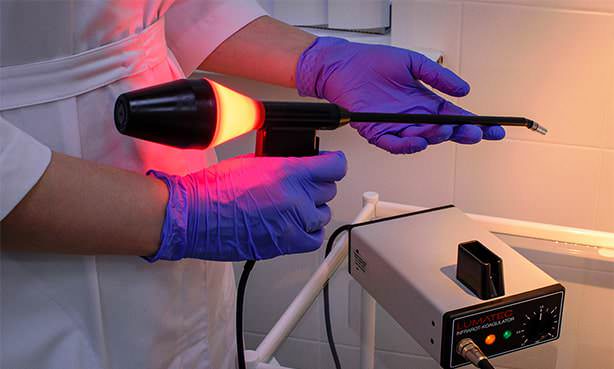 Аппарат для фотокоагуляции