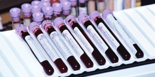 общий анализ на тиф