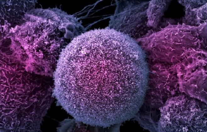 реактивный лимфоцитоз