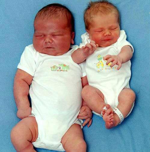 Макросомия