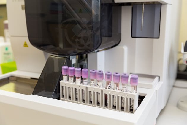 Исследование крови