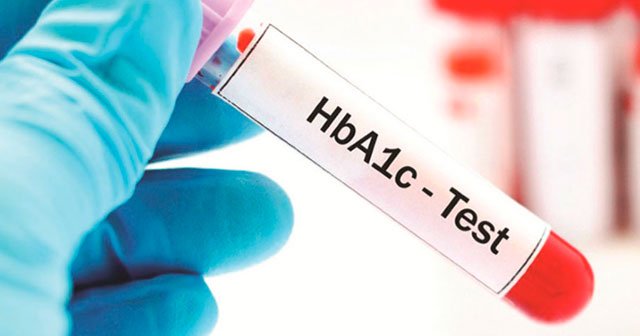 кровь для пробы