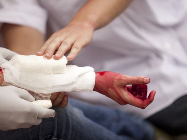 Артериальное кровотечение