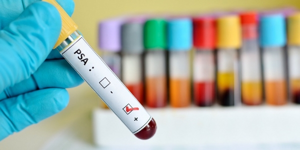 Норма ПСА в крови