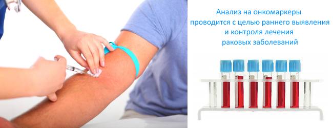анализ на онкологию