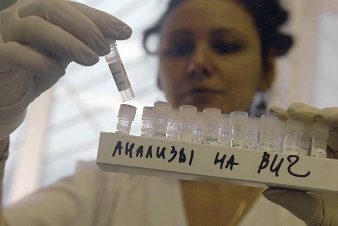 Общий анализ крови при ВИЧ показатели, указывающие на вирус