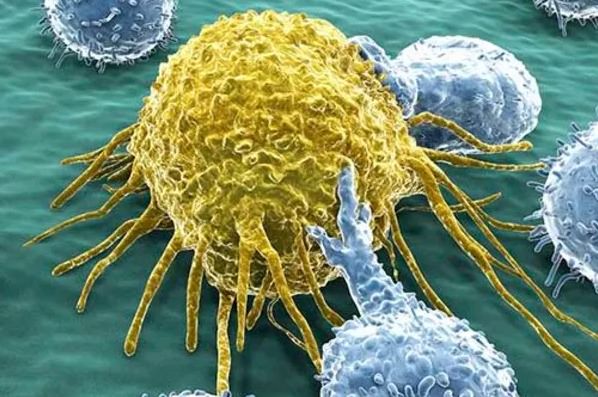 олосатоклеточный лейкоз