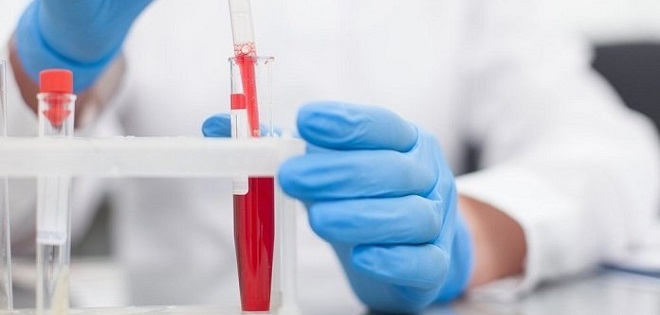 результаты анализов