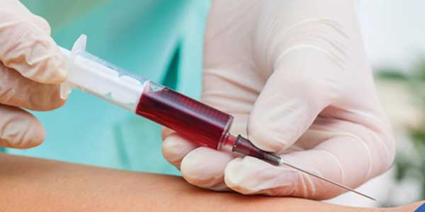 кровь из вены