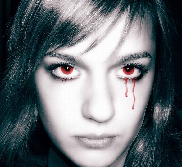 Лопнул сосуд в глазу причины, что делать и как лечить