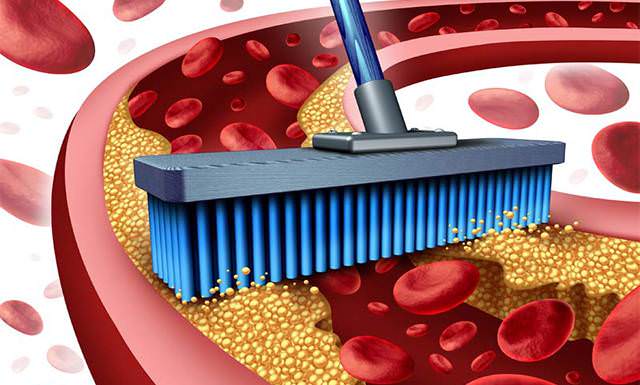 «Чистка» сосудов