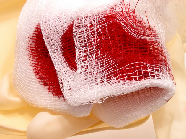 Бинт в крови